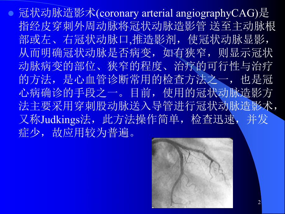 冠状动脉造影术的术前及术后护理PPT课件.ppt_第2页