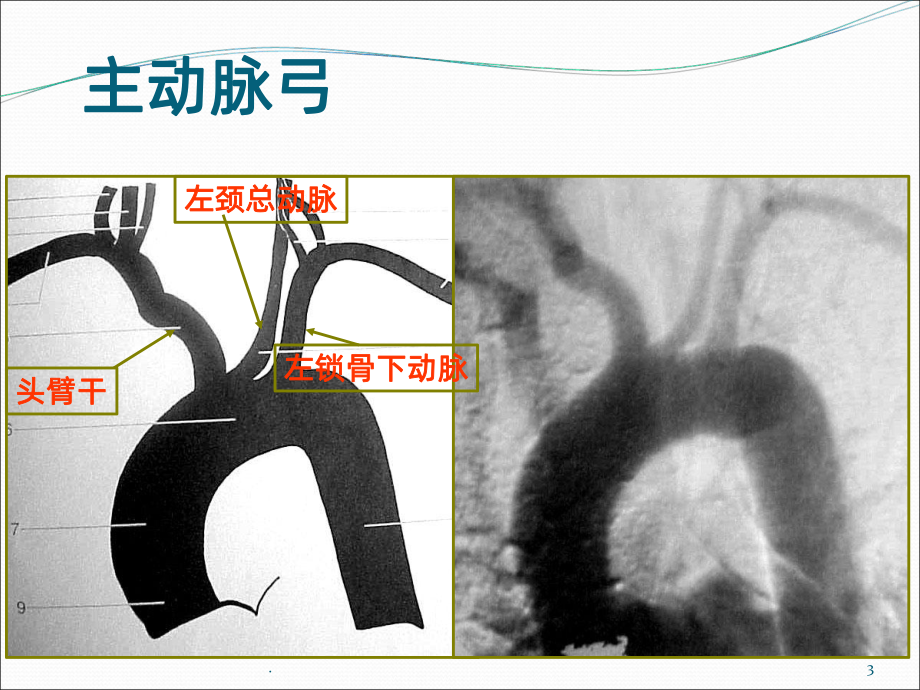 头颈部动脉解剖PPT课件.ppt_第3页