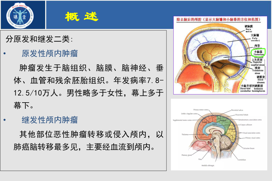 颅内肿瘤临床表现与诊断课件.ppt_第2页