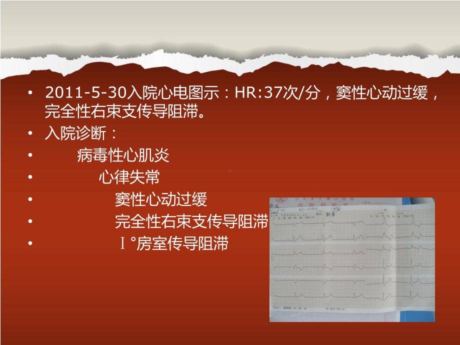 心脏起搏器患者护理查房课件.ppt_第3页