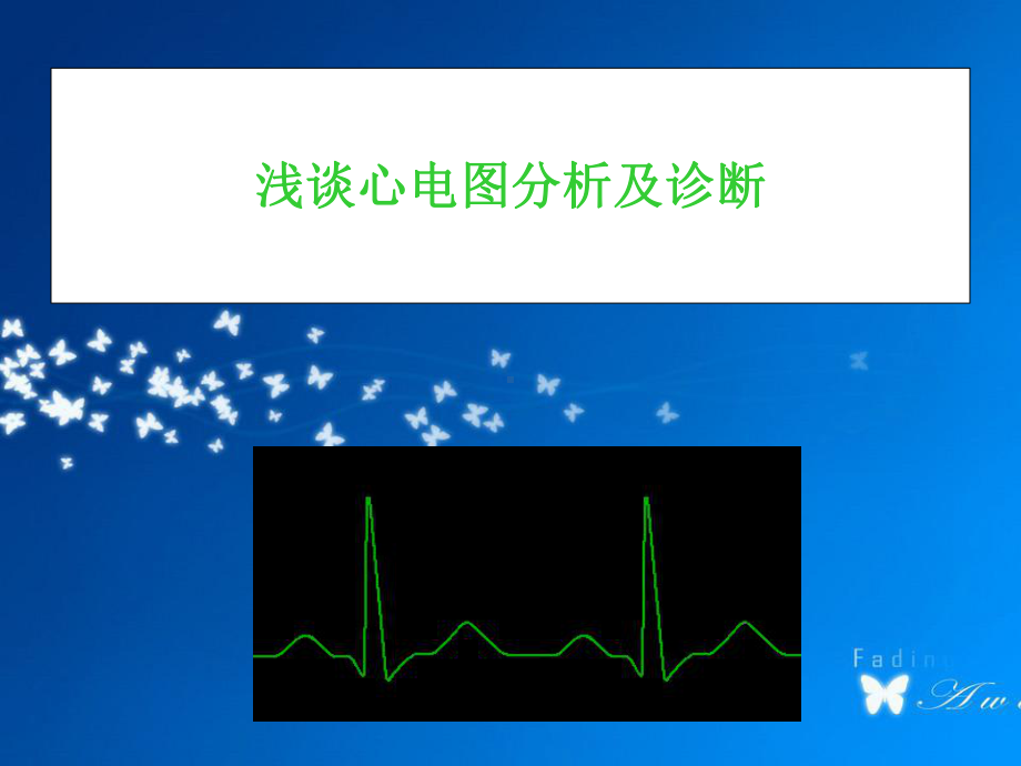 浅谈心电图分析及诊断课件.ppt_第1页