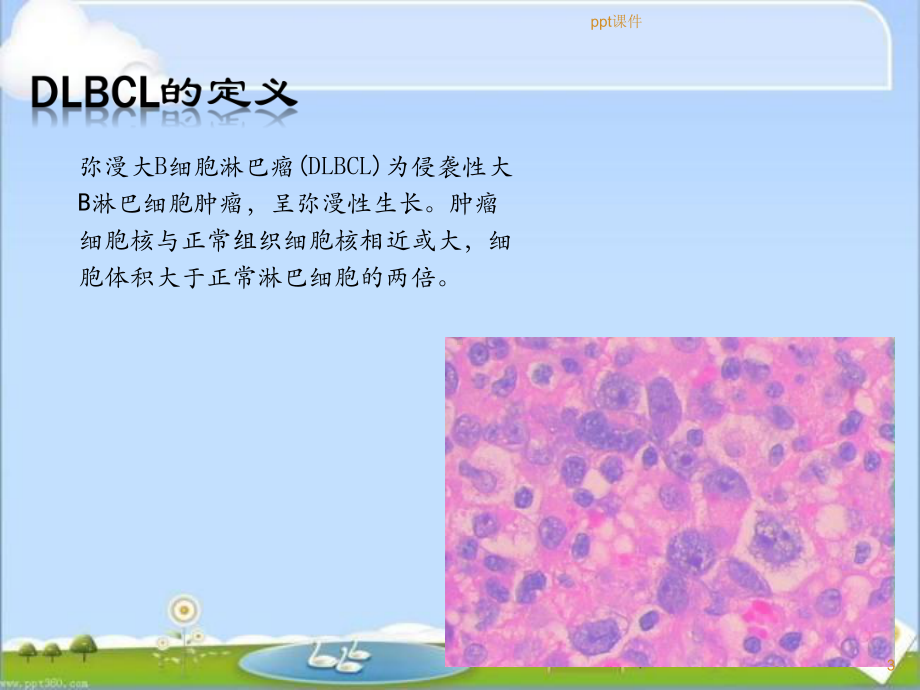 弥漫大B细胞淋巴瘤的影像学诊断与疗效评估-pp课件.ppt_第3页