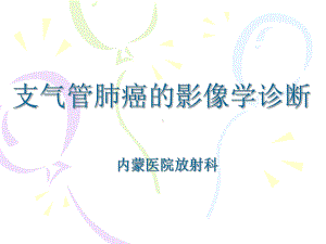 支气管肺癌的影像学诊断课件.ppt