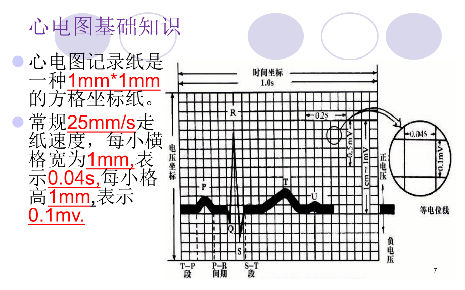 心肌梗死治疗及护理PPT课件.ppt_第2页