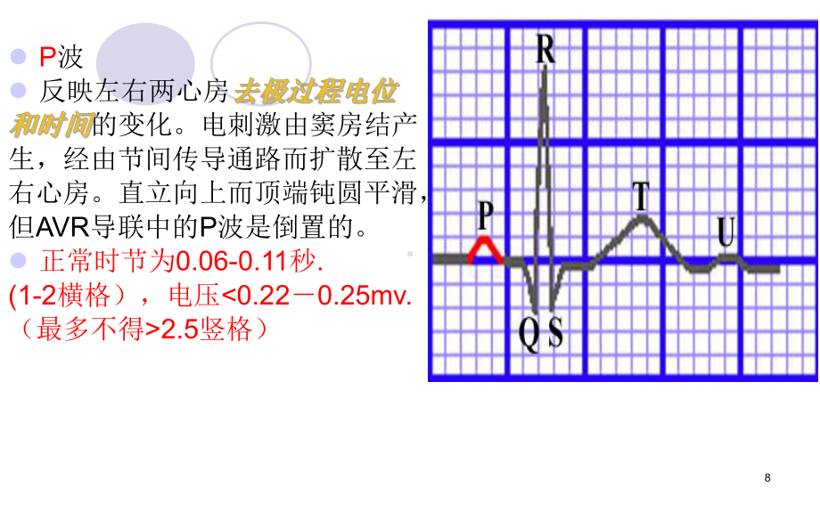 心肌梗死治疗及护理PPT课件.ppt_第3页