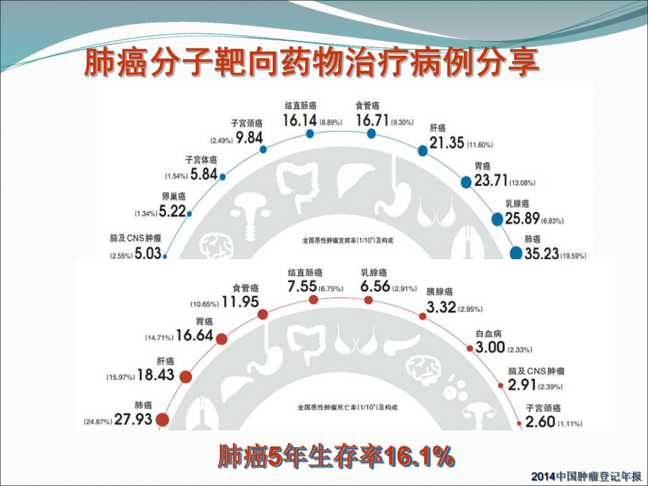 肺癌分子靶向药物治疗病例分享-ppt课件.ppt_第2页