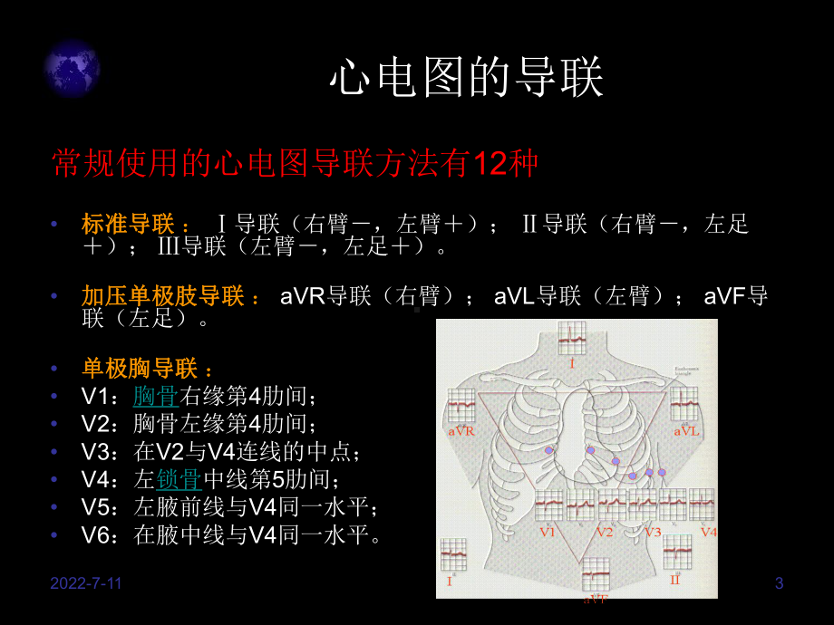 护士阅读心电图能力培养课件.ppt_第3页