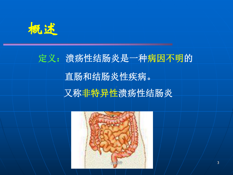 溃疡性结肠炎-ppt课件.ppt_第3页