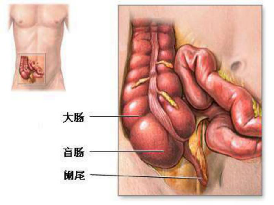 阑尾炎-(2).ppt课件.ppt_第2页