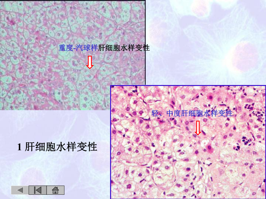 病理切片(复习26张)课件.ppt_第3页