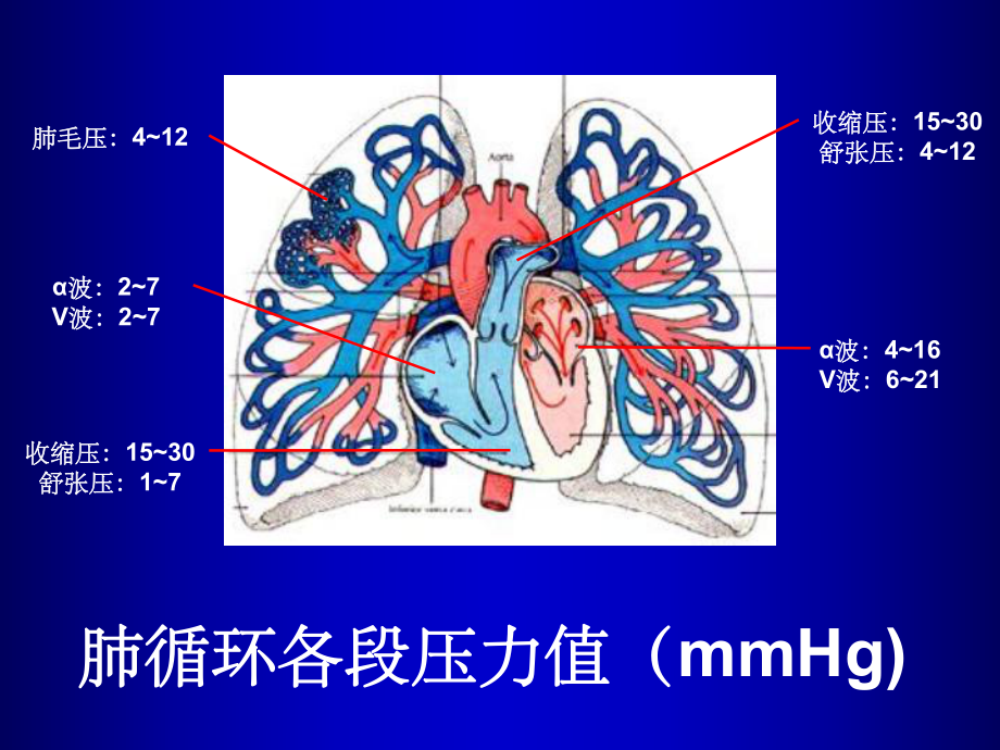 肺动脉高压最新版ppt课件.ppt_第3页