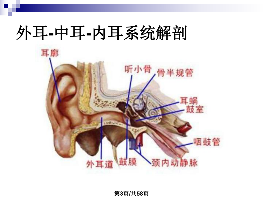 大前庭导水管综合征影像诊断课件.pptx_第3页