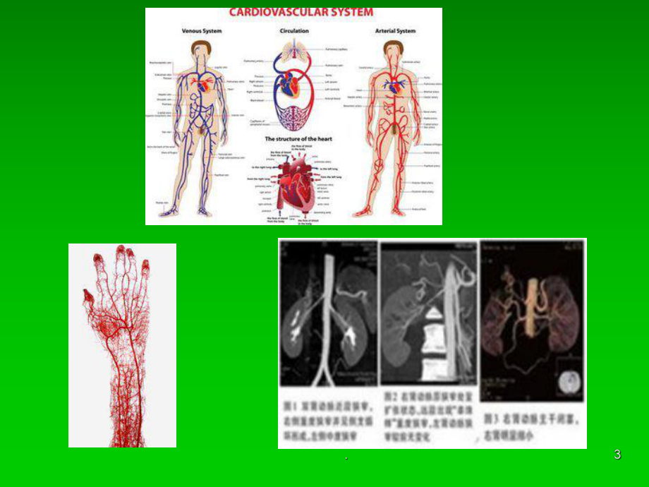 血管病变及防治ppt课件.ppt_第3页