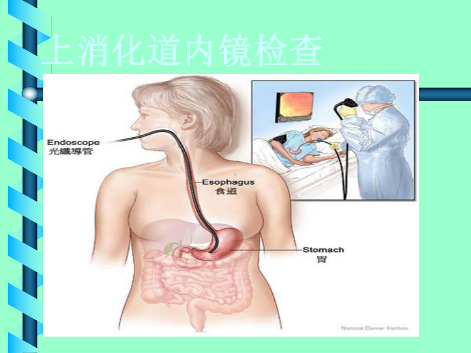 胃肠镜检查前后注意事项课件.ppt_第2页