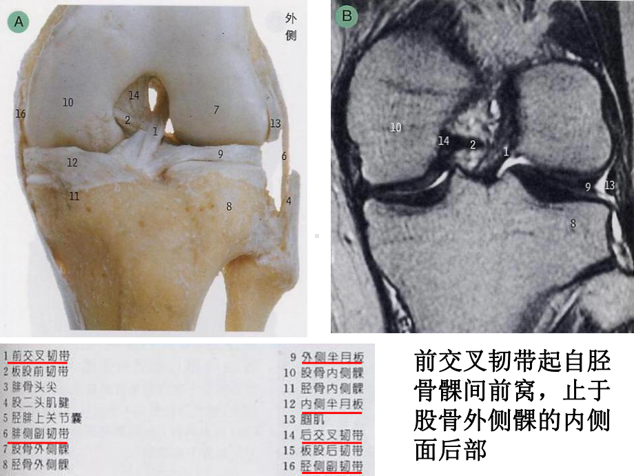 膝关节解剖及MRI诊断课件.ppt_第3页