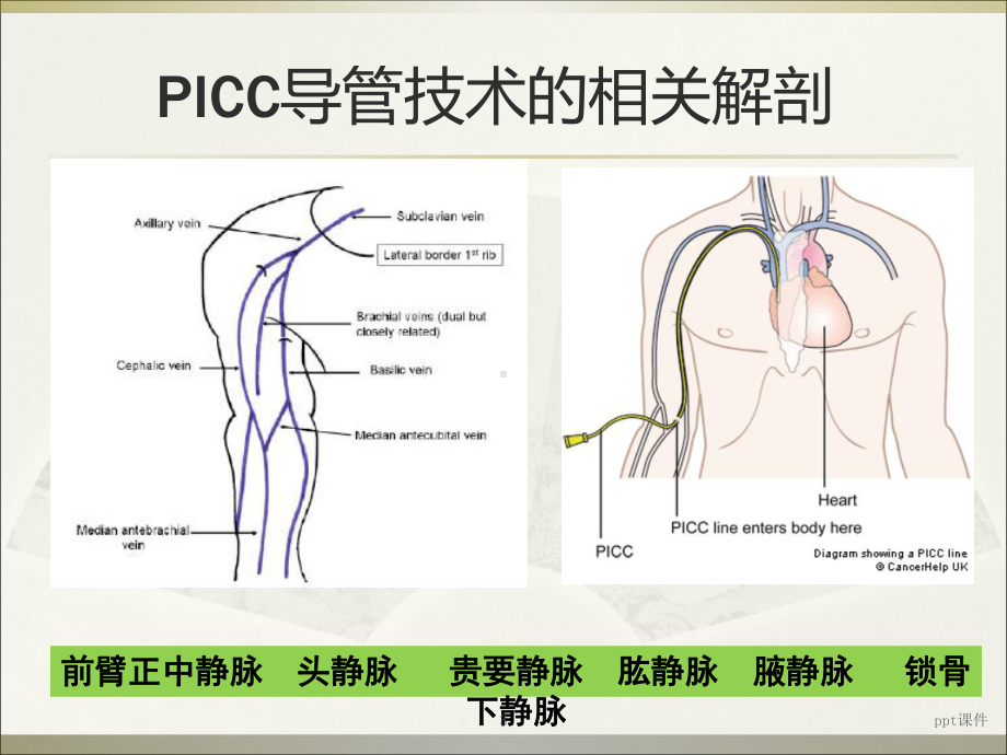 PICC导管头端定位与并发症处理-ppt课件.ppt_第3页