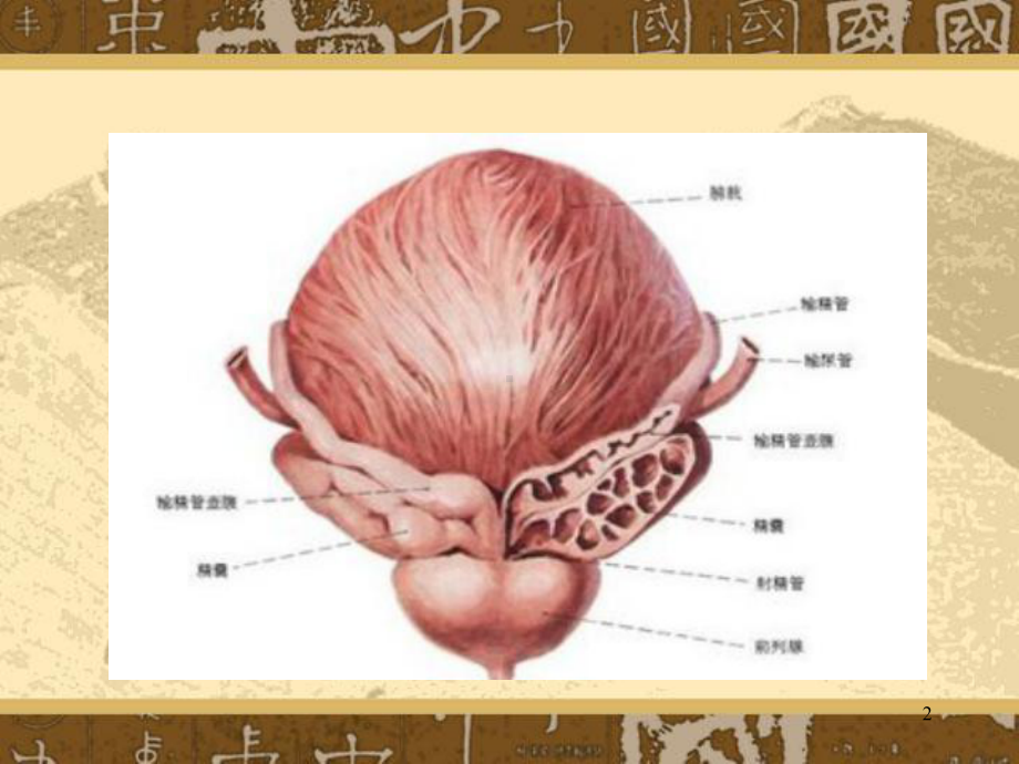 膀胱肿瘤护理PPT课件.ppt_第2页