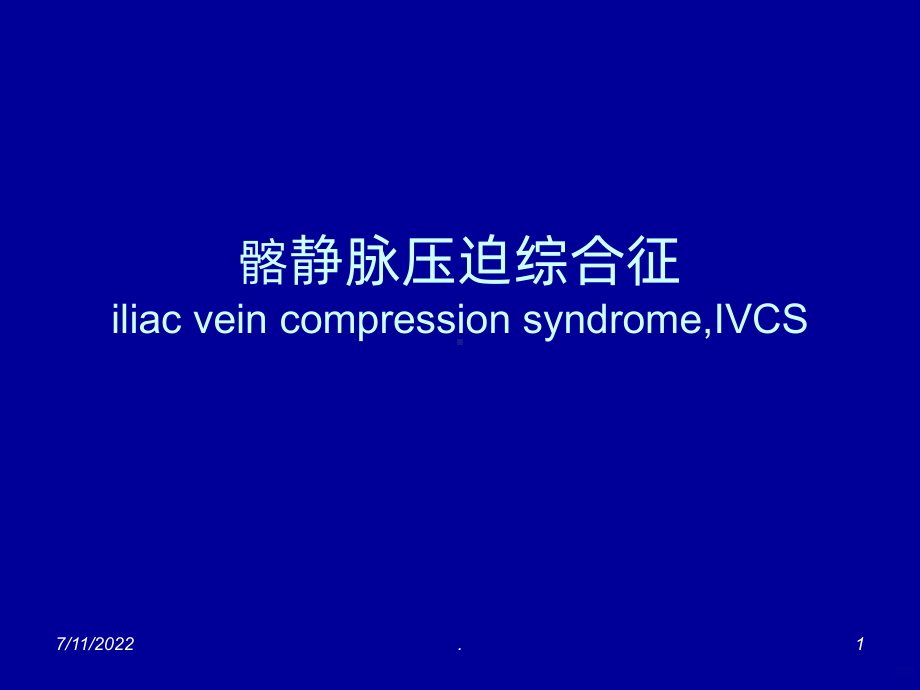 髂静脉压迫综合征PPT课件.ppt_第1页