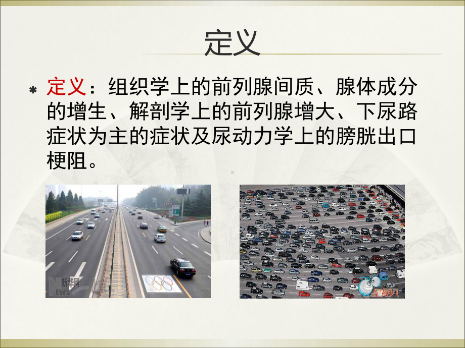 良性前列腺增生的治疗ppt课件.ppt_第2页