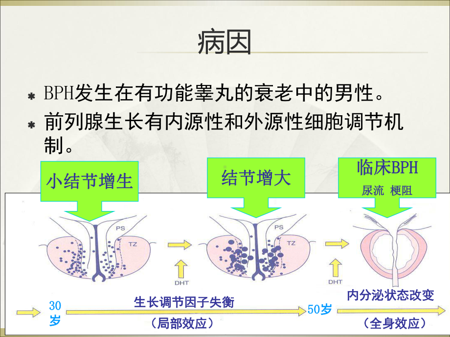 良性前列腺增生的治疗ppt课件.ppt_第3页