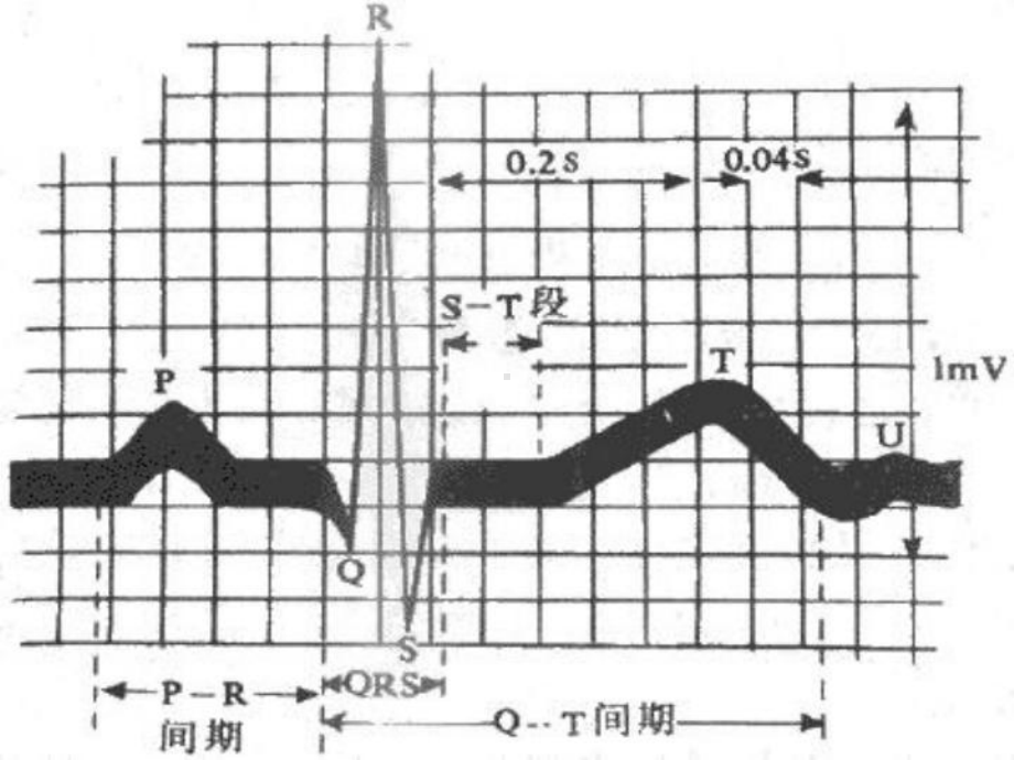 心电图完整版-赵贵林课件.ppt_第3页