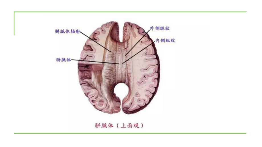 胼胝体的病变你会诊断嘛？课件.pptx_第2页