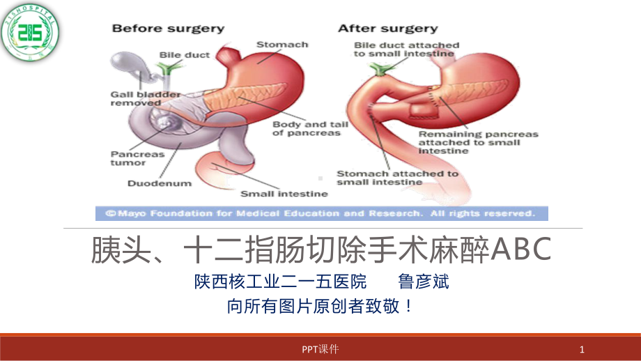 胰腺、十二指肠手术麻醉-ppt课件.ppt_第1页