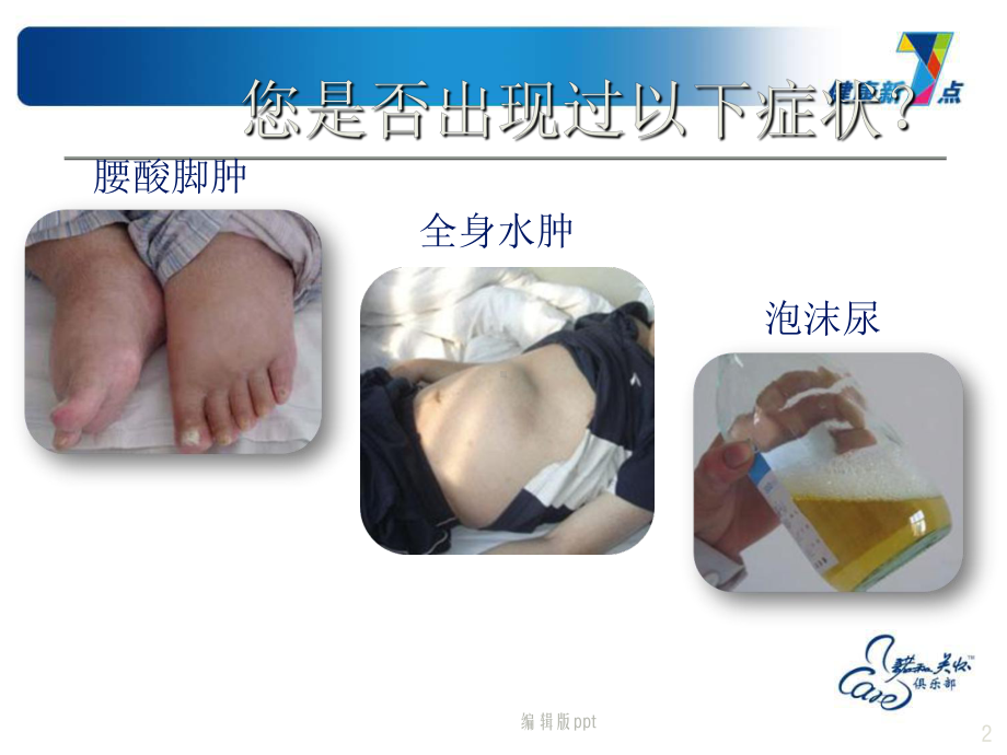 糖尿病肾病健康宣教课件.ppt_第2页