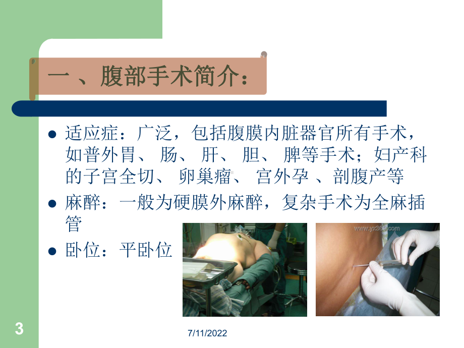 腹部手术配合常规-精品课件.ppt_第3页