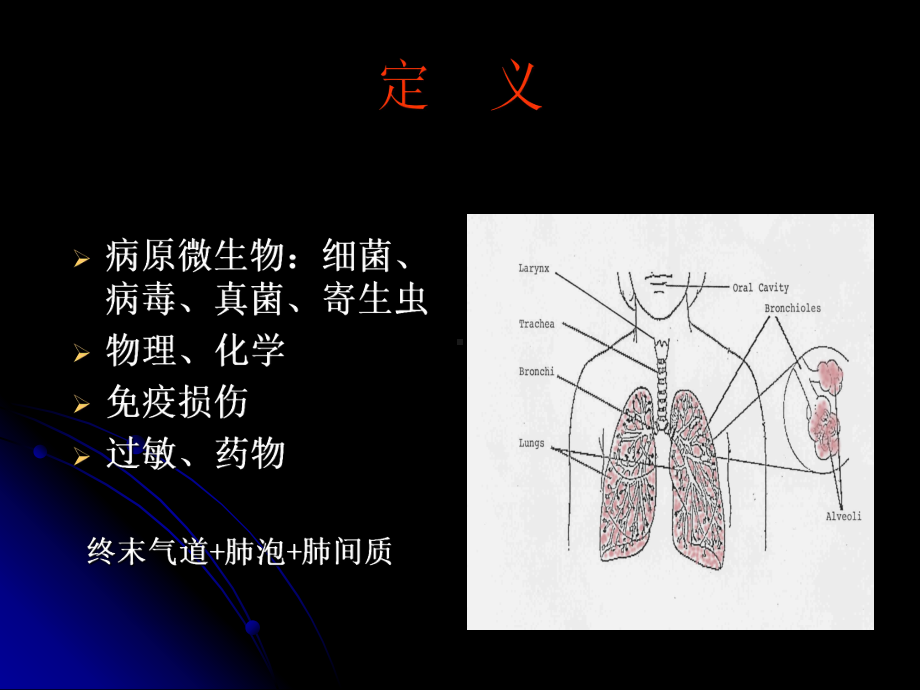 不明原因肺炎讲座简述课件.ppt_第3页