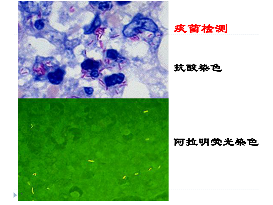 结核病病理学PPT课件.ppt_第2页