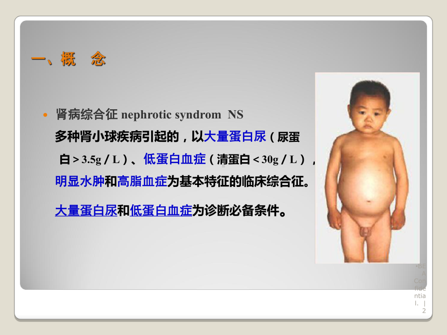 29肾病综合征病人护理课件.ppt_第2页