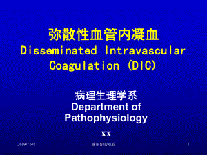 弥散性血管内凝血分析课件.pptx