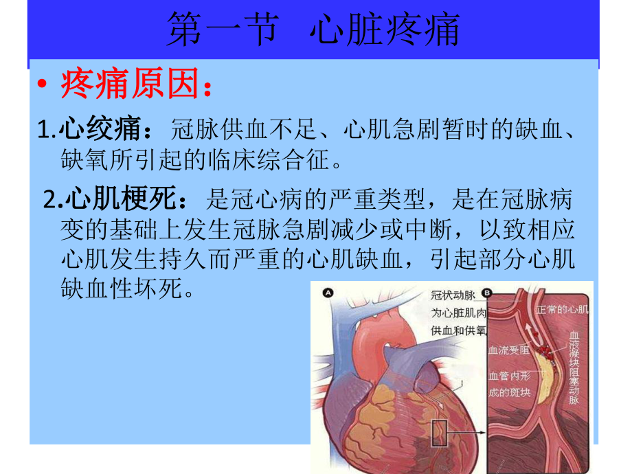 胸腹部疾病疼痛的护理课件.ppt_第3页