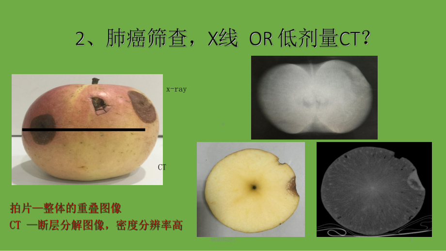 早期肺癌低剂量CT筛查1课件.ppt_第3页