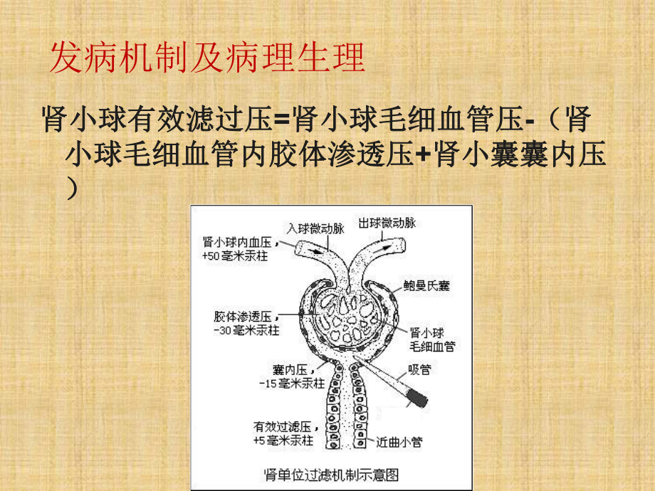 急性肾损伤与血液净化治疗课件.ppt_第3页