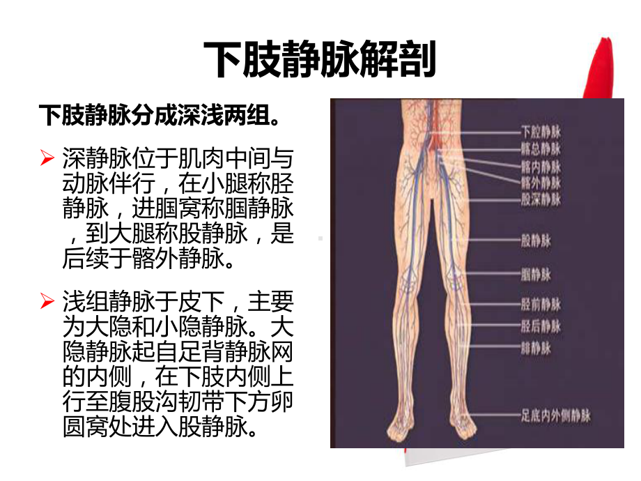 DVT的预防及护理课件.pptx_第3页