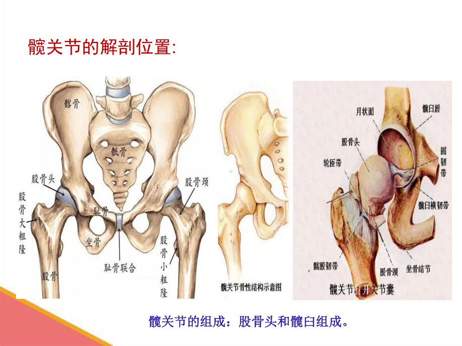 髋关节置换术-叶丽课件.ppt_第3页