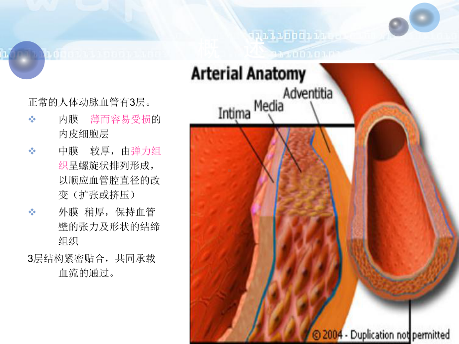 主动脉夹层的护理ppt课件.ppt_第3页