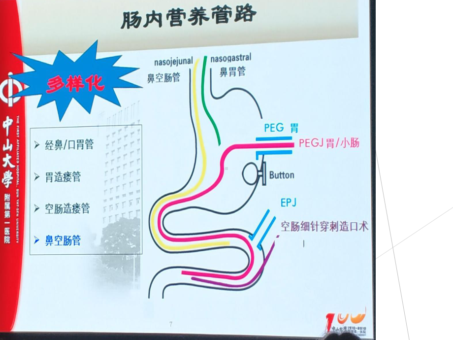 空肠营养管的护理完整版课件.ppt_第2页