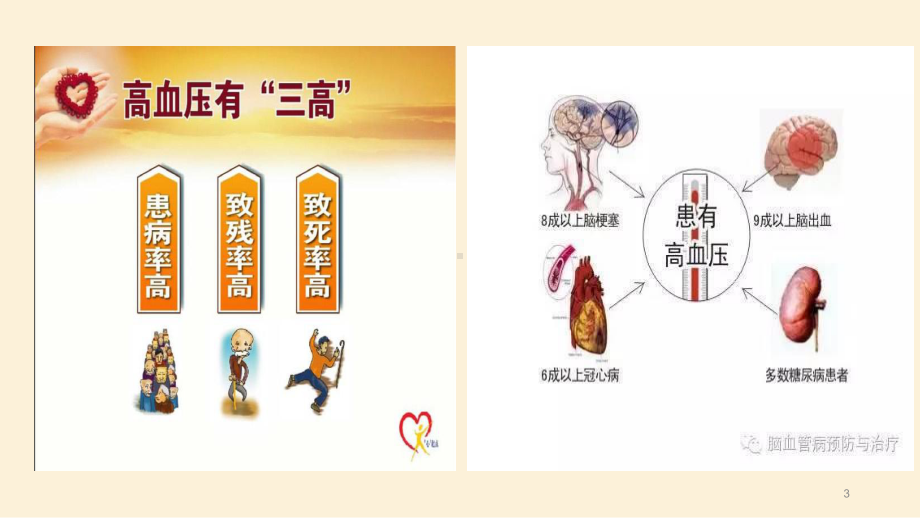 高血压病治疗与护理ppt课件.ppt_第3页