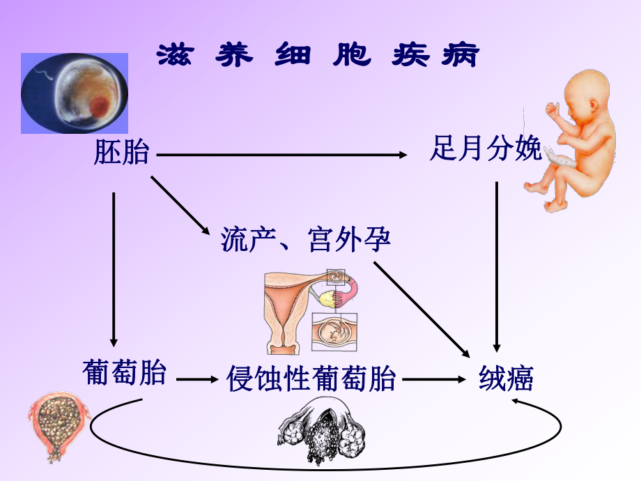 滋养细胞疾病患者的护理课件.ppt_第3页