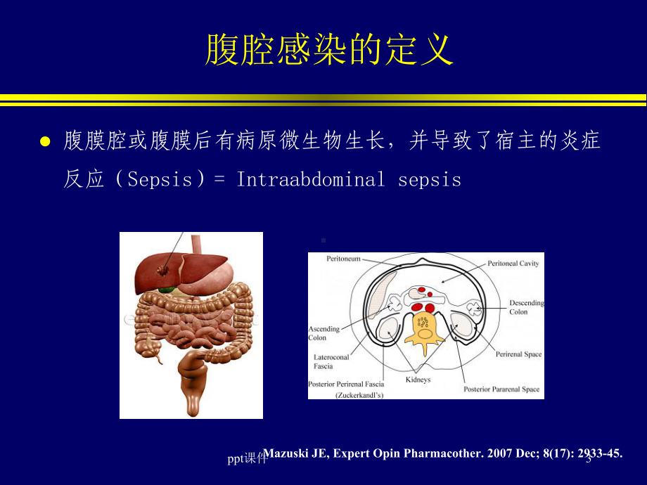 腹腔感染的治疗-ppt课件.ppt_第3页