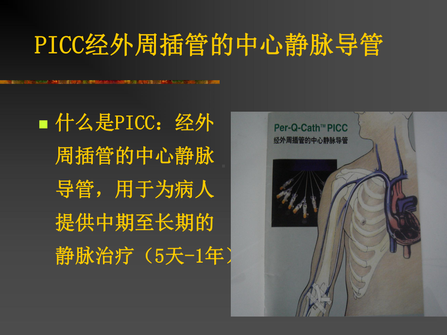 最新PICC常见并发症和处置主题讲座课件.ppt_第1页