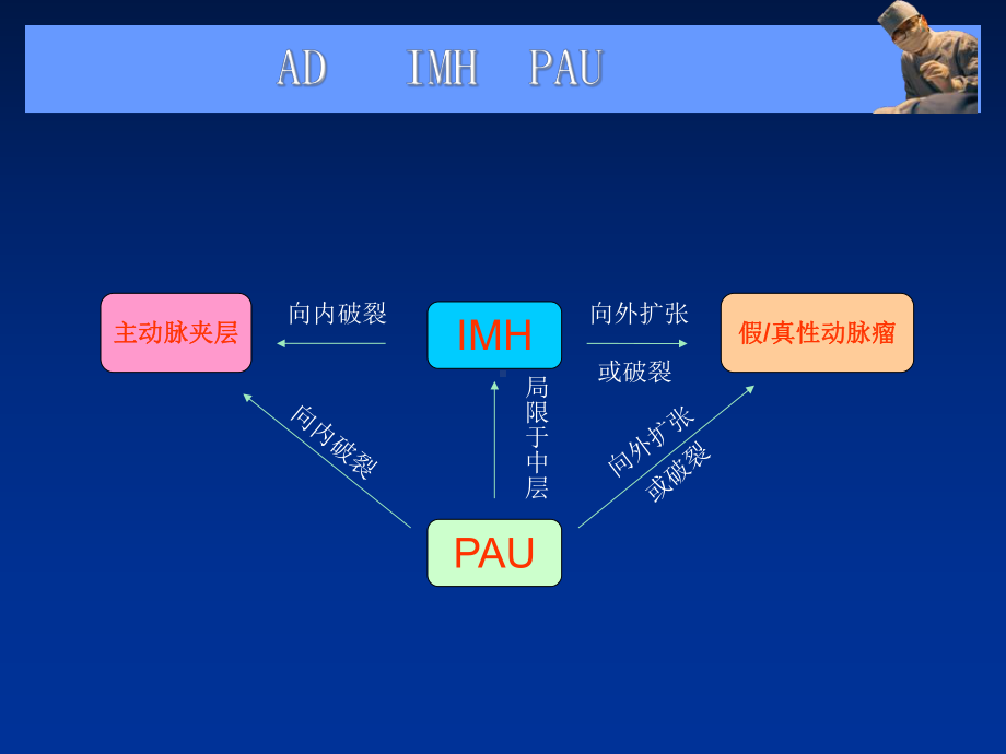 主动脉夹层壁间血肿及穿通性溃疡的影像诊断与鉴别诊断课件.ppt_第3页