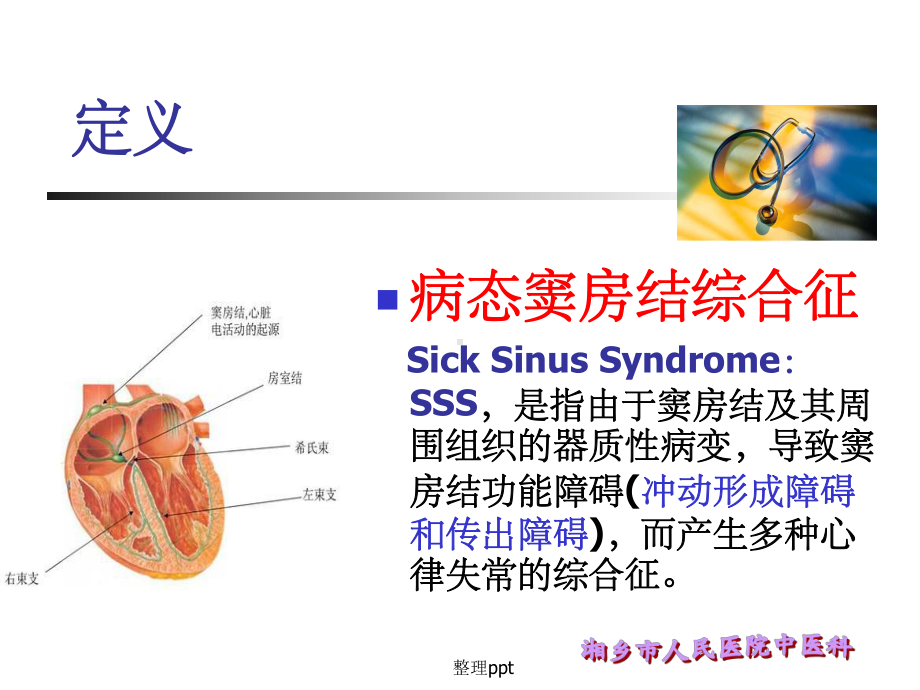 病窦综合征的护理查房课件.ppt_第2页