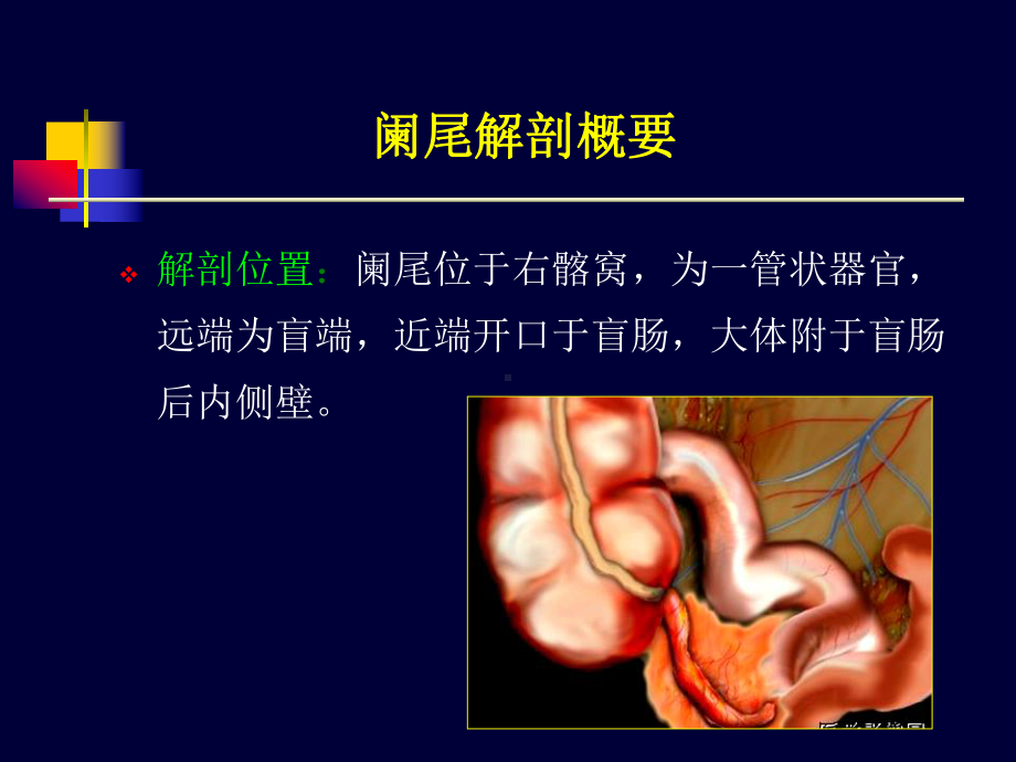 （推荐下载）阑尾炎超声诊断课件.ppt_第3页