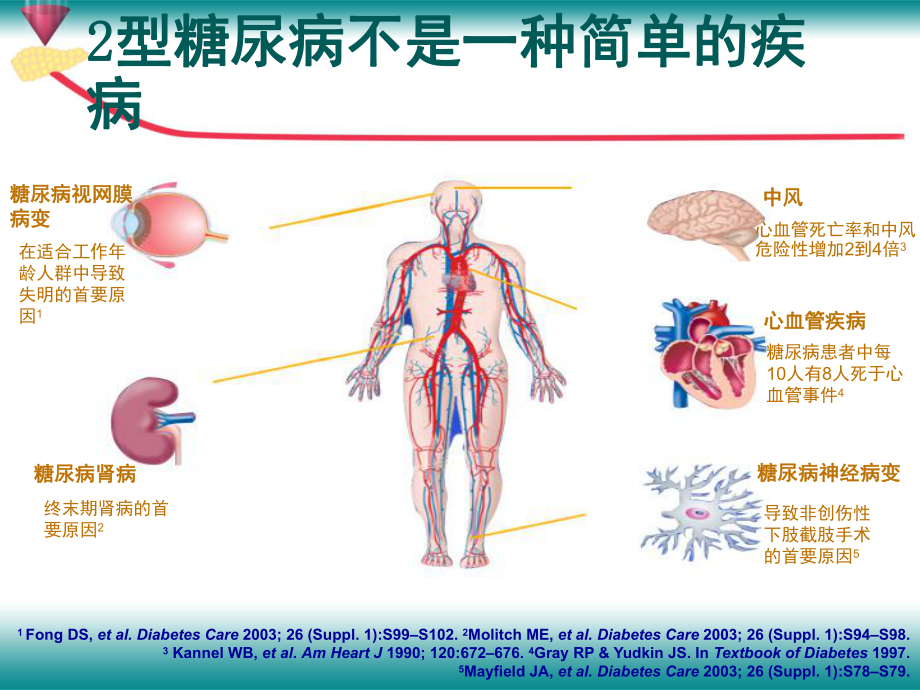 糖尿病视网膜病变-ppt课件1.ppt_第2页