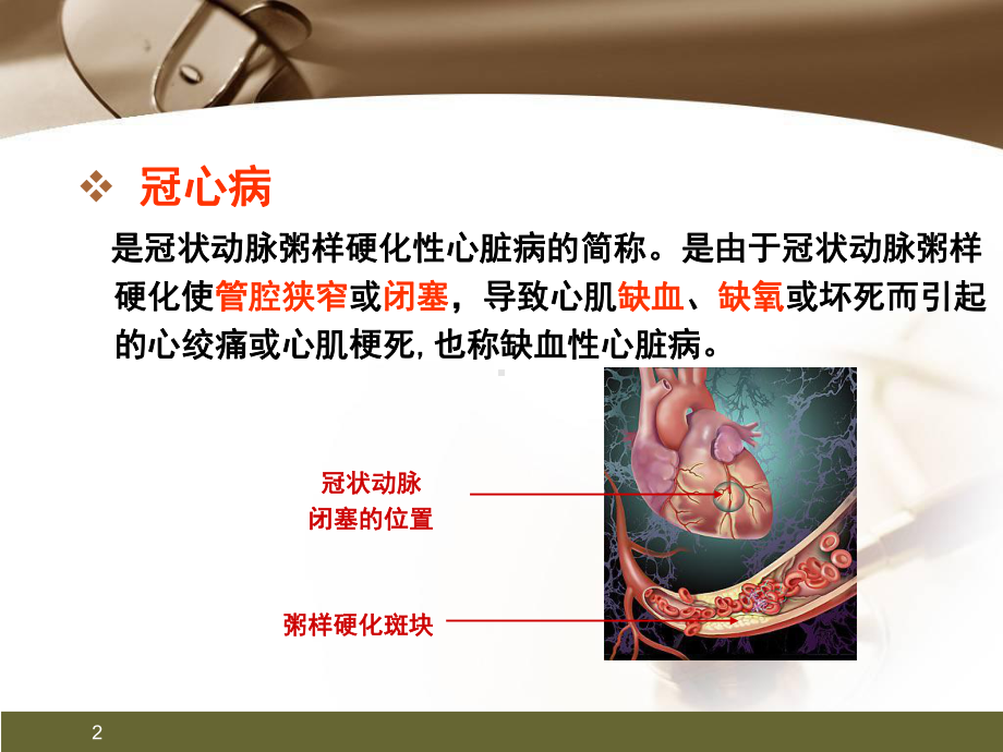 心肌梗死健康宣教幻灯片精品PPT课件.pptx_第2页