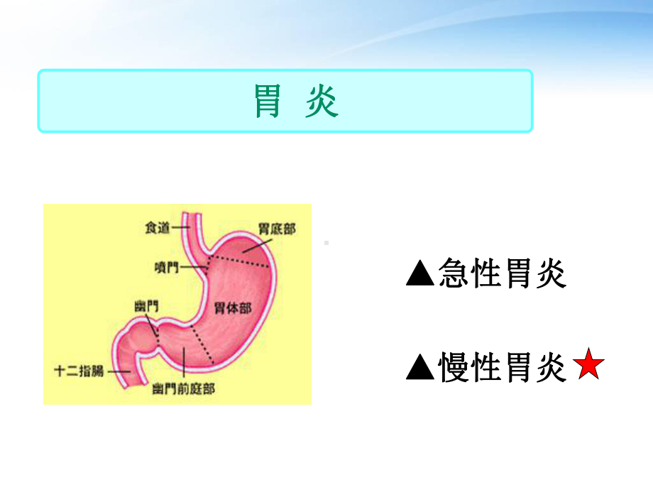 《内科护理学》胃炎的护理-ppt课件.ppt_第2页